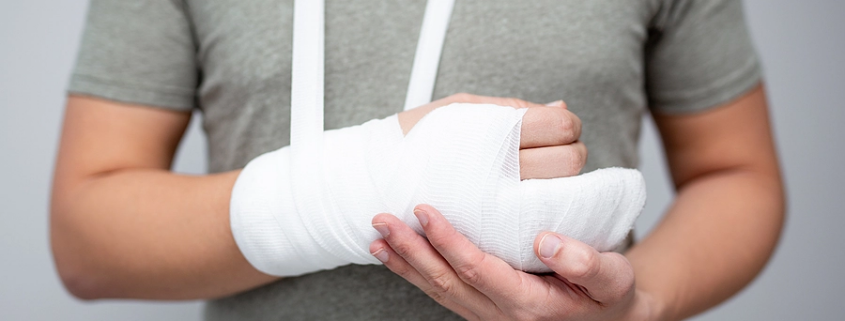 Man with broken arm in cast
